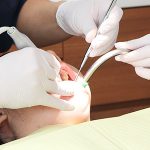 歯の根の治療について