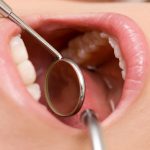 歯の根に膿が溜まったときの治療方法